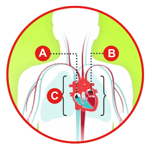 Types of heart failure diagram