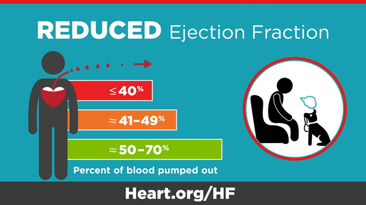 how-can-i-improve-my-low-ejection-fraction-professional-heart-daily