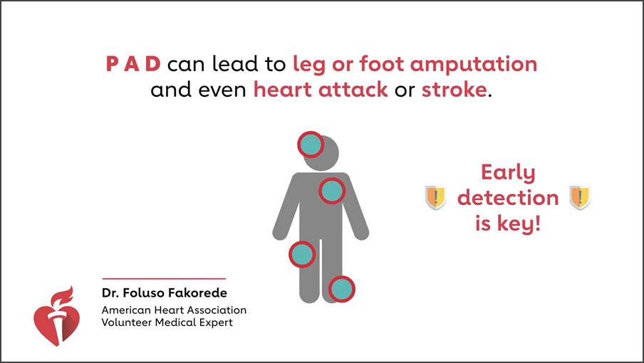 Symptoms of PAD Professional Heart Daily American Heart Association