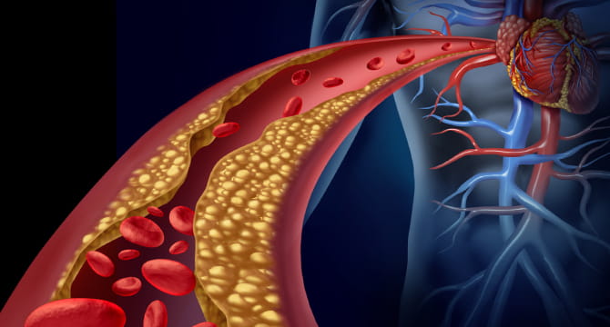 South Asians' High Risk Of Cardiovascular Disease Has Been Hidden By A ...