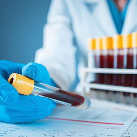 Closeup of gloved laboratory specialist comparing blood vials to data on sheet of paper.