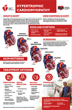 A thumbnail image of the Hypertrophic Cardiomyopathy infographic in collaboration with HCMA