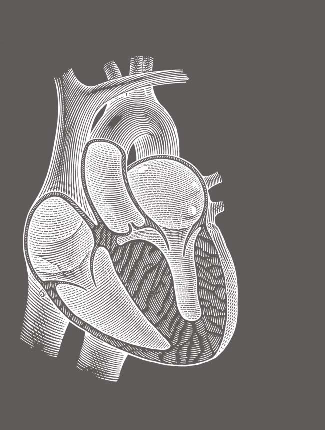 Hypertrophic Cardiomyopathy for Professionals - Professional Heart ...