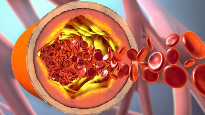 An Illustration of blood cells flowing through an artery.