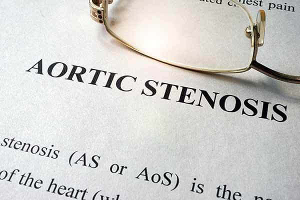 Aortic stenosis written on page