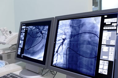 Two monitors  showing  imaging being used during a surgical precedure.
