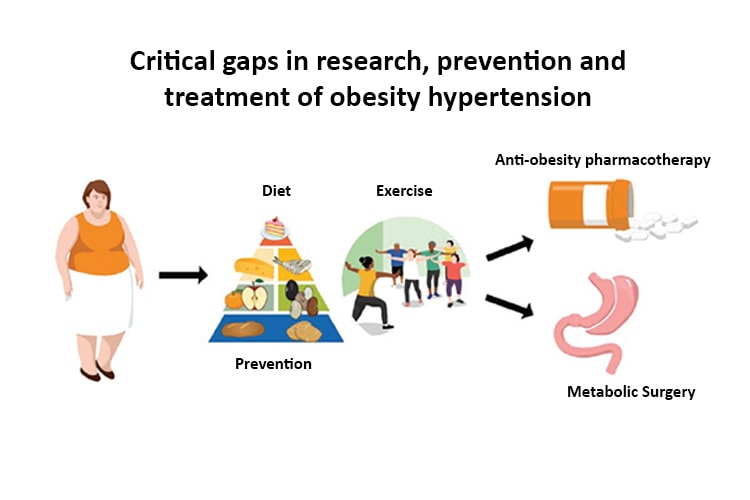 Figure 2. Critical gaps remain in research and implementation of appropriate therapies (diet, increased physical activity, reduced sedentariness, anti-obesity pharmacotherapy, and metabolic surgery) in obesity hypertension. BMI indicates body mass index; CKD, chronic kidney disease; and HF, heart failure.