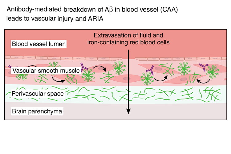 The multifaceted role of Vascular Neurologists in the care of ...