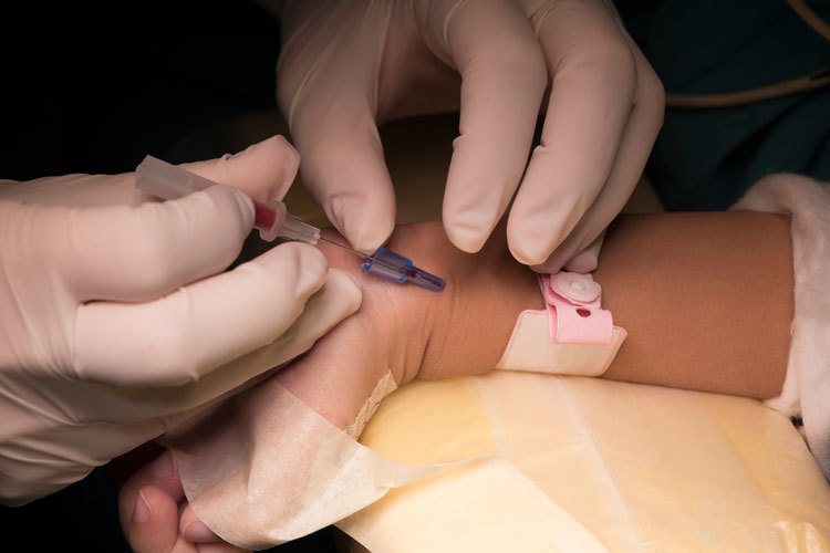 Doctor withdrawing the needle for arterial line