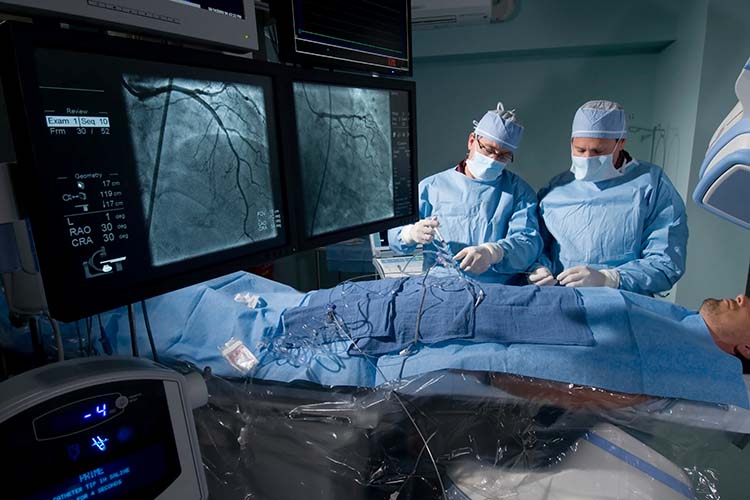 doctors performing cardiac catheterization
