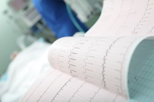 ECG interpretation in the intensive care