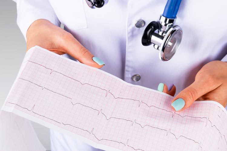 electrocardiogram in hand of a female doctor