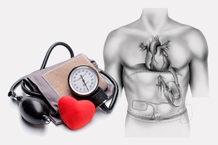 Blood pressure cuff and an illustration of a heart pump on a light gray background