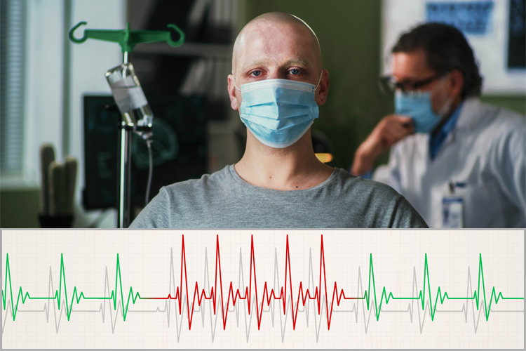 Bald man with cancer wearing mask and looking at camera while sitting near oncologist during chemotherapy session in hospital with a medicine banner illustrating sudden arrhythmia. heart rate increasing more than 90 beats per minute underneath.