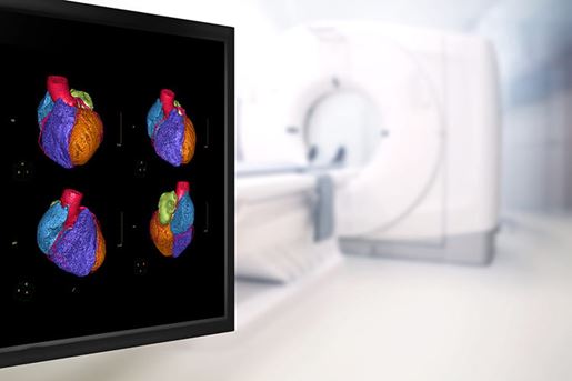 Selective focus of CTA Coronary artery 3D rendering image on the monitor in CT Scanner room at the hospital.