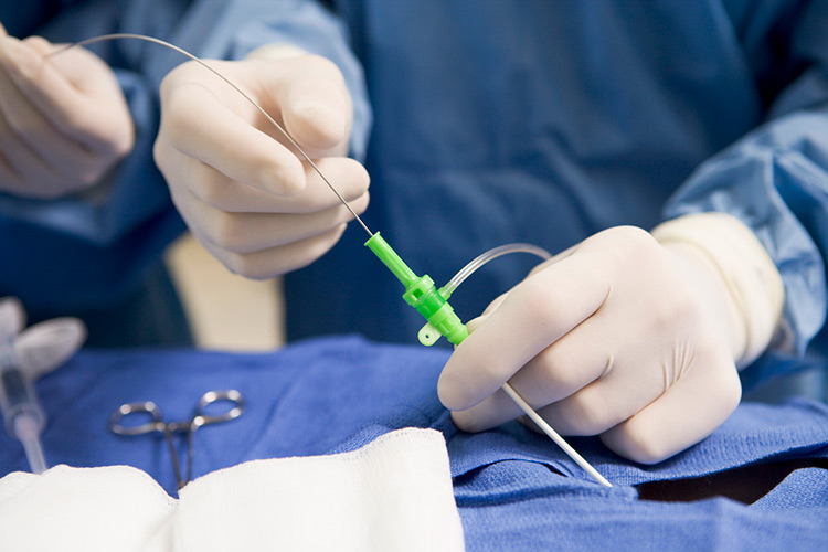 Close-up of a Surgeon performing surgery.