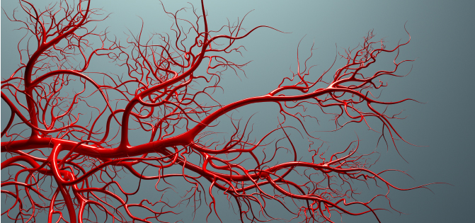 vasculardisease1