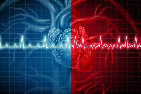 Illustration of heart, heartbeat showing AFib