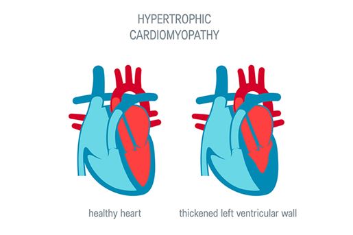 Heart disease vector concept in flat style stock illustration Heart disease vector concept in flat style stock illustration
