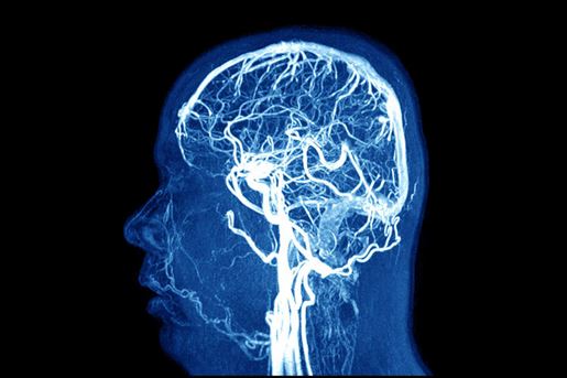 imaging of the brain on mri scan