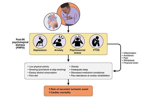 Figure Biologically plausible mechanisms by which MI leads to PMPD, which in turn leads to increased cardiac risk