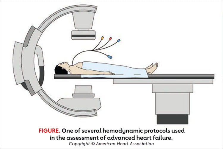 Figure 1 One of several hemodynamic protocols used in the assessment of advanced heart failure