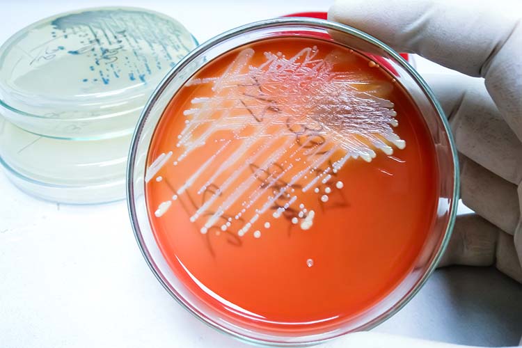 image of hand holding petri dish