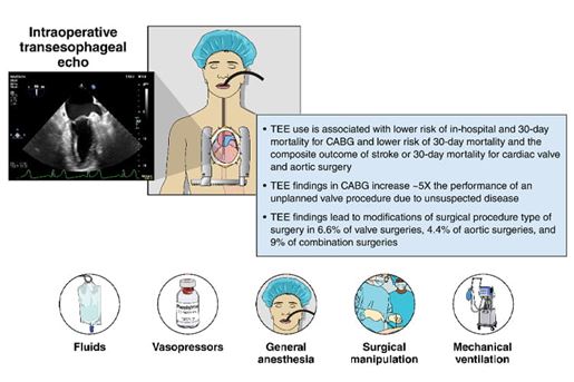 intraoperative transesophageal echo image