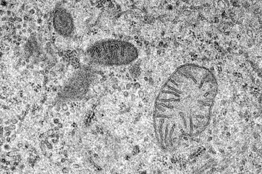 mitochondria